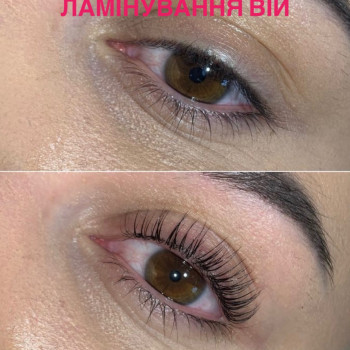 Ламінування вій
                    Мастер депиляции Міла Киев