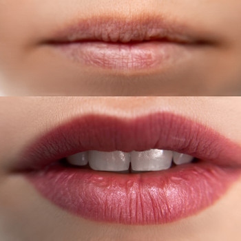 Елена Данилюк, Киев Фото - 1