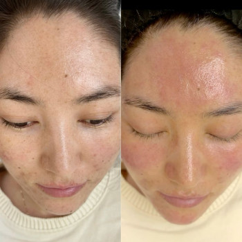 Фото из портфолио косметолога Юлія Кушнір (Луцк)