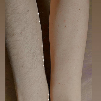 Депиляция воском
                    Мастер депиляции Виталина Полтава