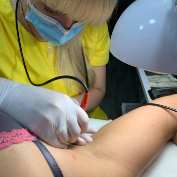 Електроепіляція
                    Майстер депіляції Виталина Полтава