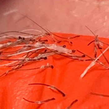 Електроепіляція
                    Майстер депіляції Виталина Полтава