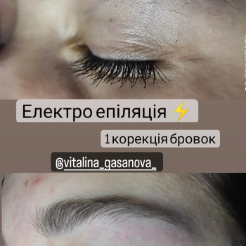 Електроепіляція
                    Майстер депіляції Виталина Полтава