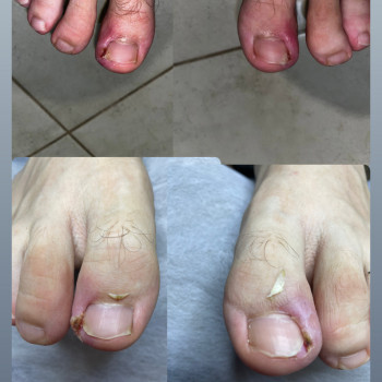 Юлія Симонец, Буча Фото - 5