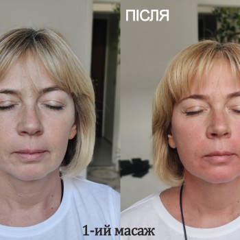  #ендосфераобличчя #апартниймасажобличчя #масажобличчя