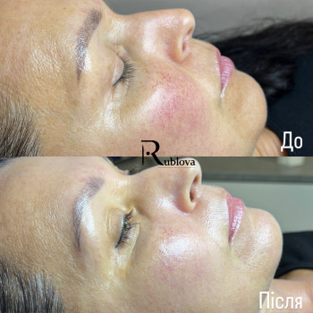 Вогонь та лід
                    Лікар-косметолог Ксенія Ужгород