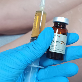 Лікування та профілактика Целюліту