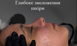 Глибоке зволоження шкіри Косметолог Ксенія Ужгород