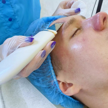 Ультразвукова чистка обличчя у чоловіків