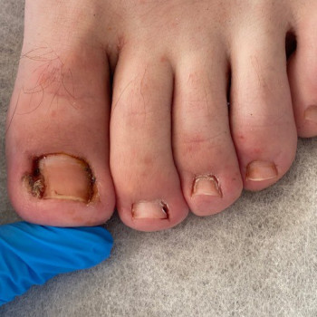 Перший візит