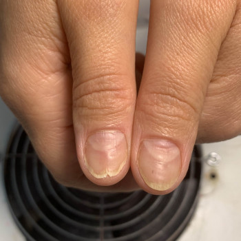 Медичний манікюр
                    Подолог Наталья Львів