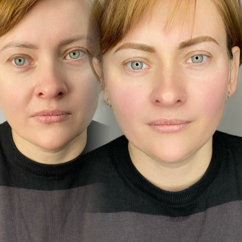 Анастасія Некрасова, Рівне Фото - 11