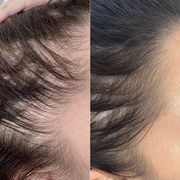 Анастасія Євдоченко, Київ Фото - 5