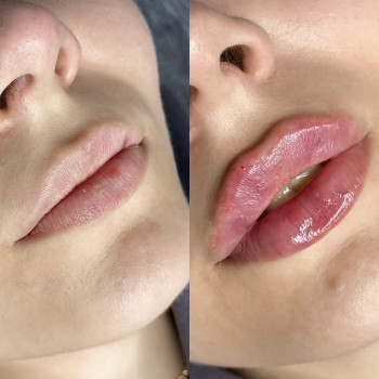 Анастасія Євдоченко, Київ Фото - 6