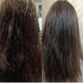 Відновлення від L'anza