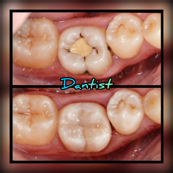 ДИТЯЧИЙ СТОМАТОЛОГ
Лікую зубки БЕЗ БОЛЮ ТА СЛІЗ

  
 
  
 
 
 