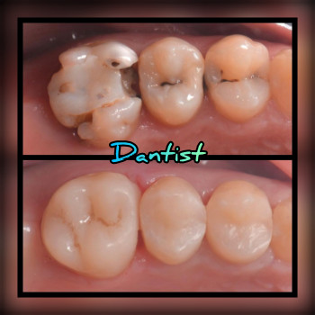 ДИТЯЧИЙ СТОМАТОЛОГ
Лікую зубки БЕЗ БОЛЮ ТА СЛІЗ

  
 
  
 
 
 