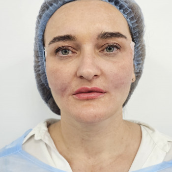 Фото з портфоліо салону Aesthetichna Gurtivnyа (косметологічний центр, Київ)