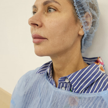 Фото з портфоліо салону Aesthetichna Gurtivnyа (косметологічний центр, Київ)