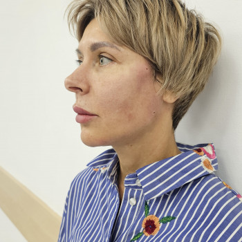 Фото з портфоліо салону Aesthetichna Gurtivnyа (косметологічний центр, Київ)