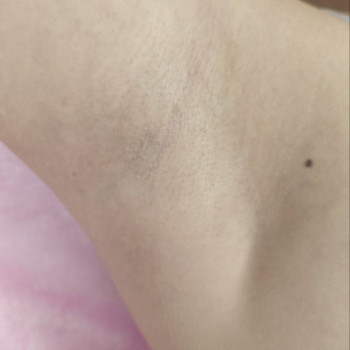 Go sugar, Городище Фото - 8