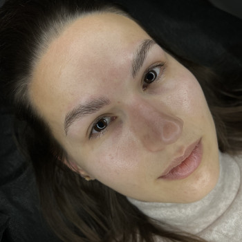 Волоски одразу після виконання процедури