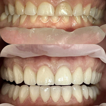 Володимир Виноградов, Черкаси Фото - 3