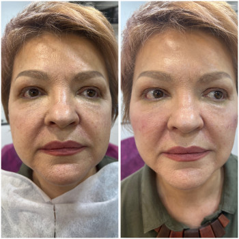 Наталья Грицай, Днепр Фото - 7