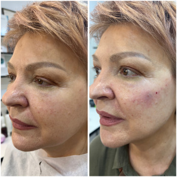 Наталья Грицай, Днепр Фото - 8