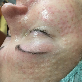 Наталья Грицай, Днепр Фото - 18