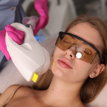 IPL Clearlight - фототерапія обличчя, видалення пігментації, видалення куперозу, лікування розацеа,...