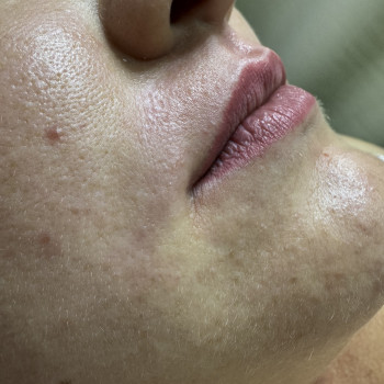 Дбайлива депіляція верхньої губи