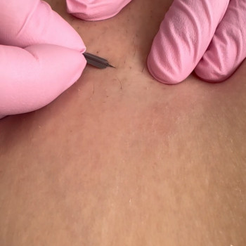 Воскова депіляція
                    Майстер воскової депіляції  Київ