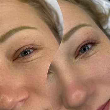 Перманентний макіяж очей(міжвійка)
                    Тату майстер Дарина Буча