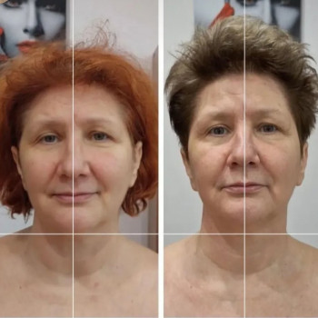 Результат роботи довжиною півроку, кроком 1 сеанс на тиждень