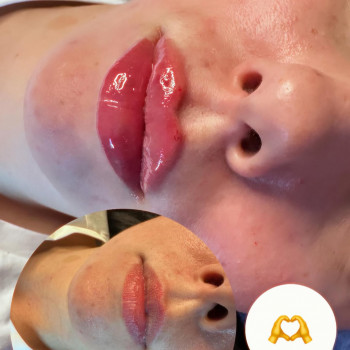 Владислава Блажко, Кривой Рог Фото - 7