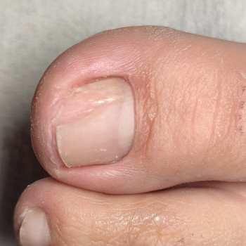 Подологічна консультація
                    Майстер манікюру  Одеса