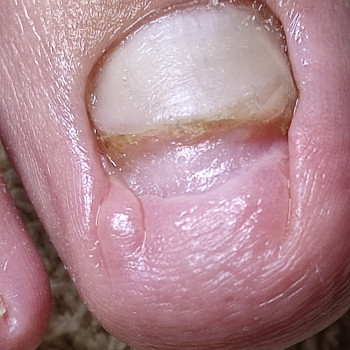 Подологічна консультація
                    Майстер манікюру  Одеса