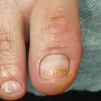 Подологічна консультація
                    Майстер манікюру  Одеса