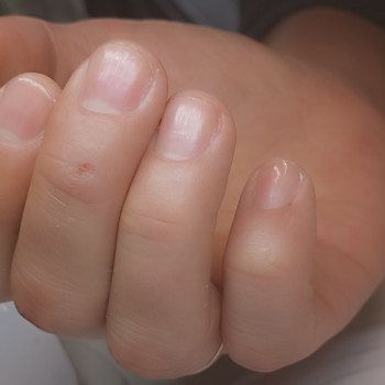 Апаратний манікюр
                    Мастер маникюра Наталя Киев