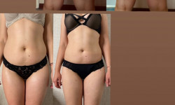 Апаратний масаж Масажист Юлія Умань