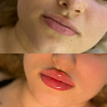 Анастасія Чуба, Одеса Фото - 13