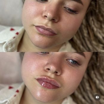 Анастасія Чуба, Одеса Фото - 7