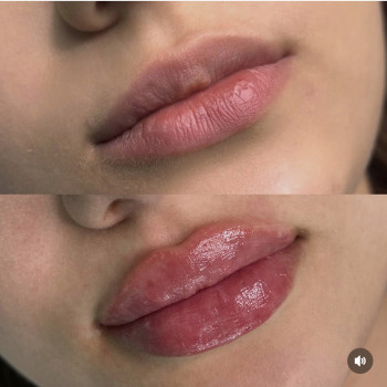 Анастасія Чуба, Одеса Фото - 8