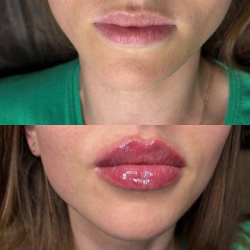 Майя Бутенко, Новомосковск Фото - 6