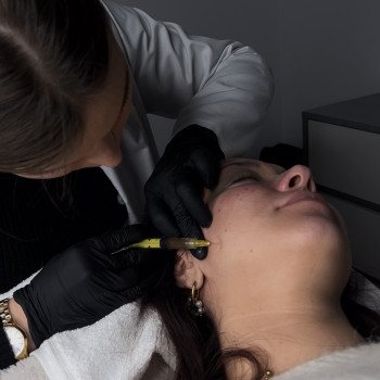 Плазмотерапія обличчя
                    Косметолог Ксенія Ужгород