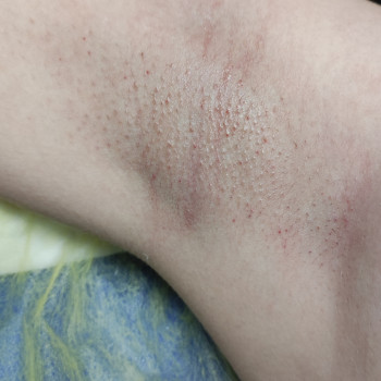 Олена Акіменко, Запоріжжя Фото - 10