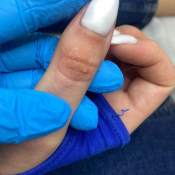 Бородавки
                    Подолог Наталья Львів