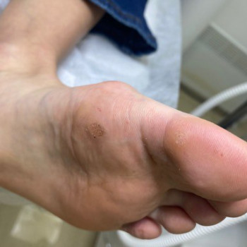 Перший візит