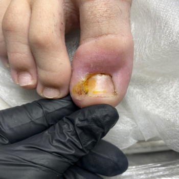 Перший візит 
15 листопада